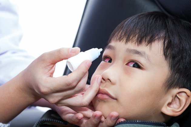 Closeup of doctor pouring eye drops in eye patient