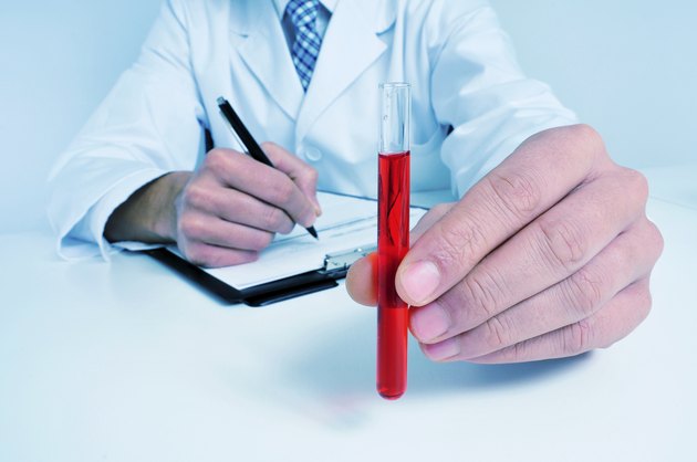 blood test