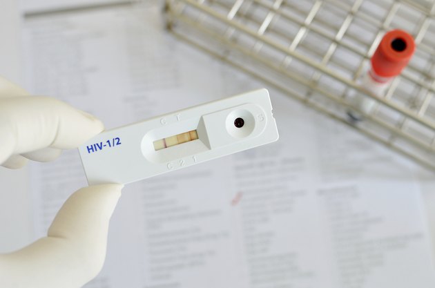 HIV positive