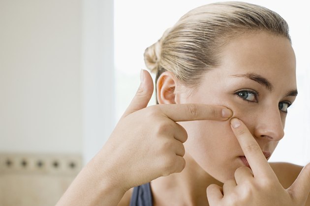 Woman squeezing spot