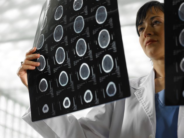 Doctor holding up x rays