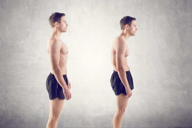 Man with impairMan with impaired posture position defect scoliosis and ideal bearing.
