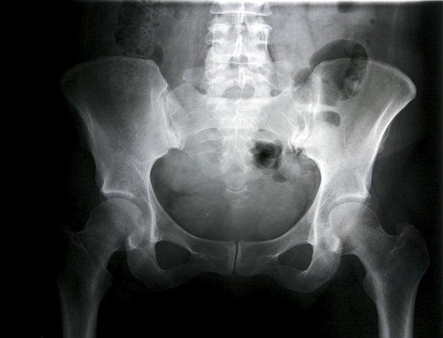Female pelvis/front view