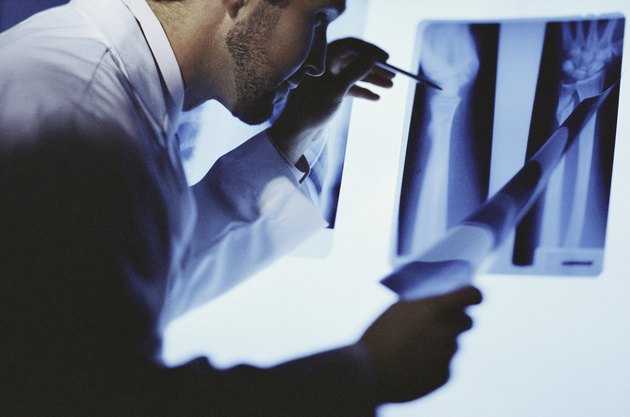Male doctor examining an X-ray