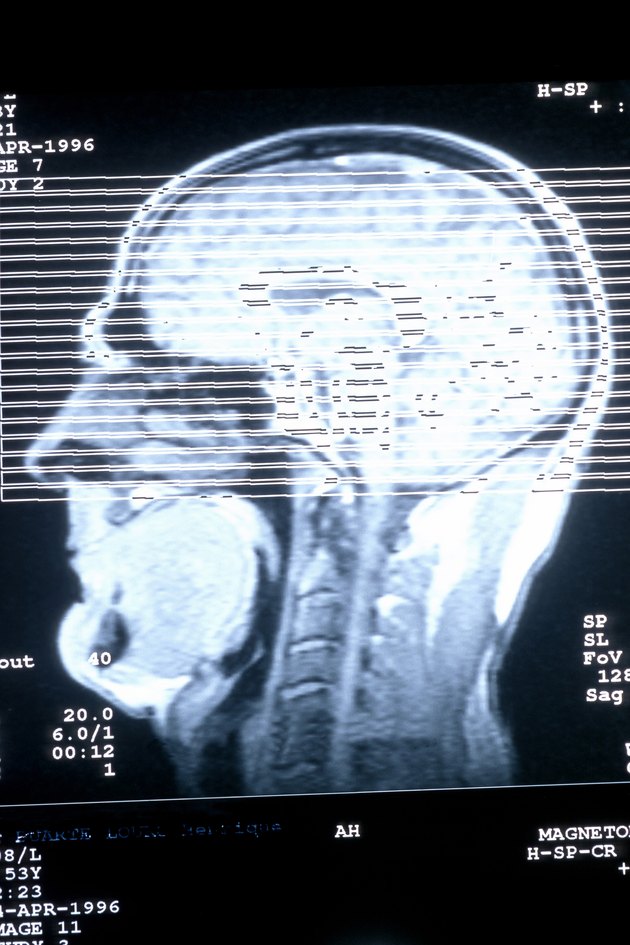 CAT scan of human head