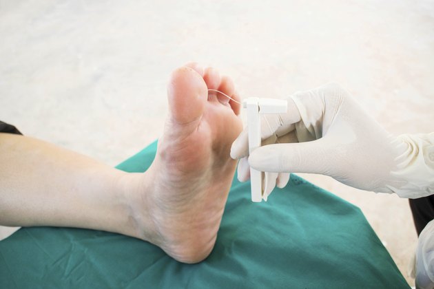 diabatic foot skining neuropathy