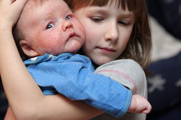 Girl embraces her brother