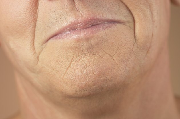 how-to-remove-smoking-wrinkles-livestrong