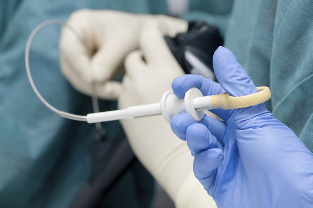 Endoscopic biopsy