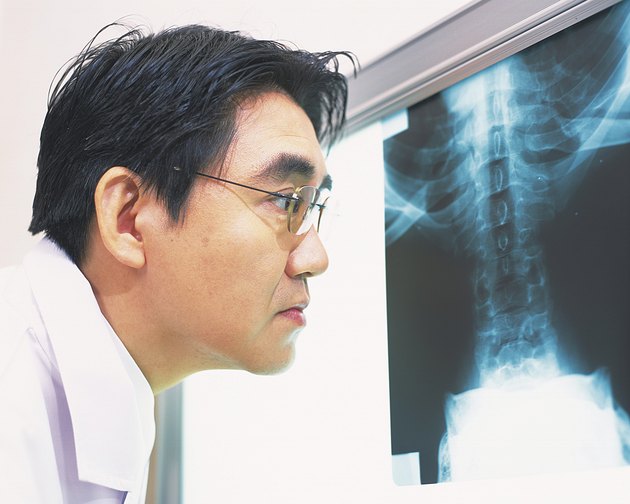 Doctor examining an x-ray