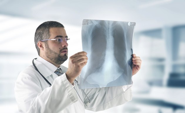 Doctor examining an X-Ray Image