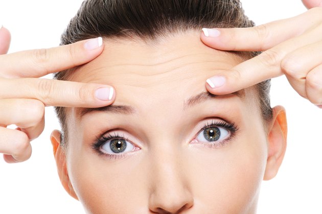 wrinkles on forehead