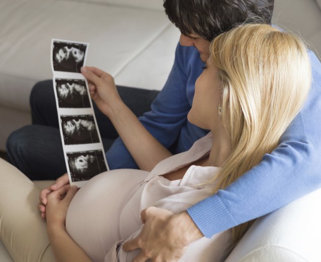 The first look at our baby