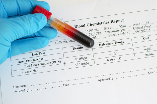 Abnormal renal function test