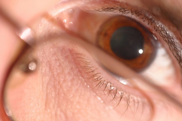 Close-up of eye