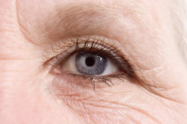 Woman's eye