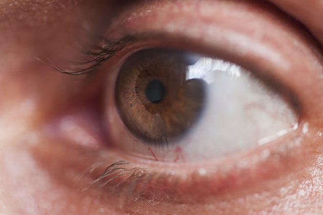 Eye macro