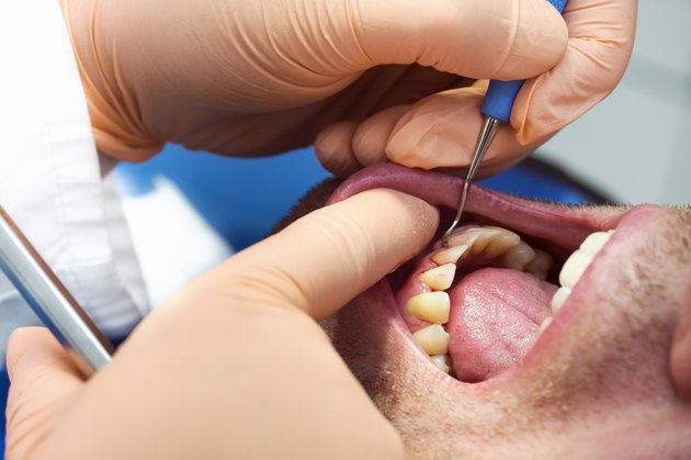Dentist and patient with parodontosis