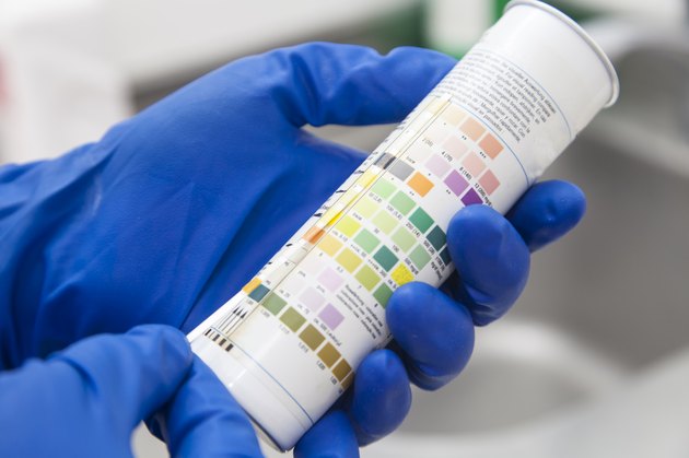 Urine test strips