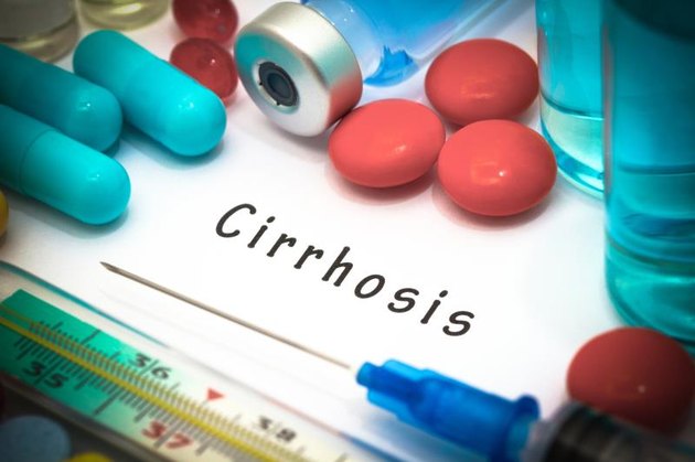 Cirrhosis - diagnosis written on a white piece of paper. Syringe and vaccine with drugs.