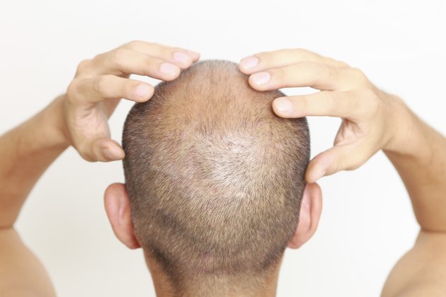 scalp massage