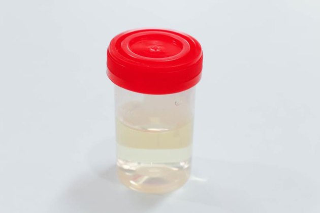 Urine sample in laboratory