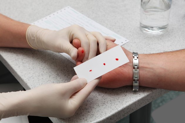 Blood group determination..
