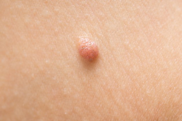 mole
