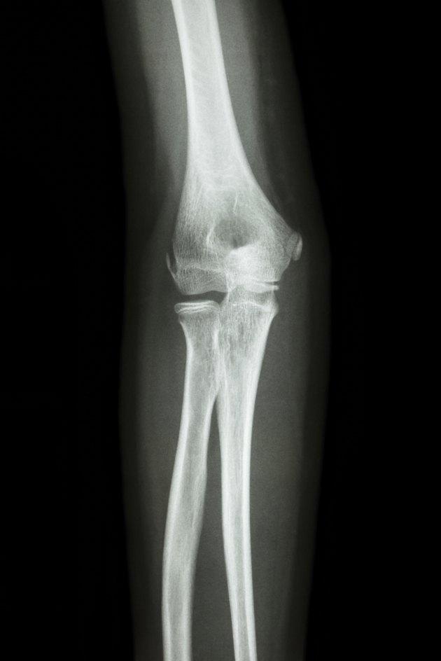 normal human's elbow