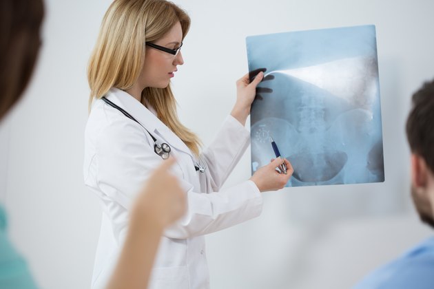 X-ray of the pelvis