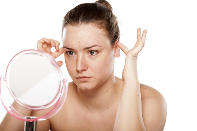 otoplasty