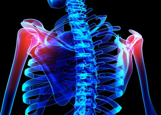 3D illustration, shoulder painful skeleton x-ray, medical concept.