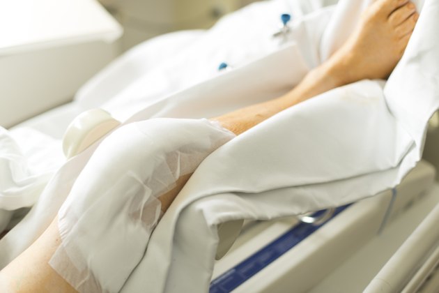Knee surgery in hospital