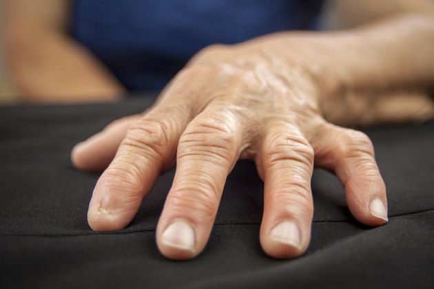 Symptoms Of Rheumatoid Arthritis In The Hands And Fingers Livestrong