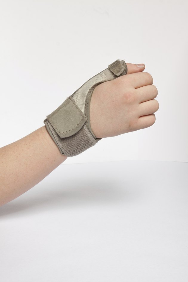 Human Hand In Thumb Brace
