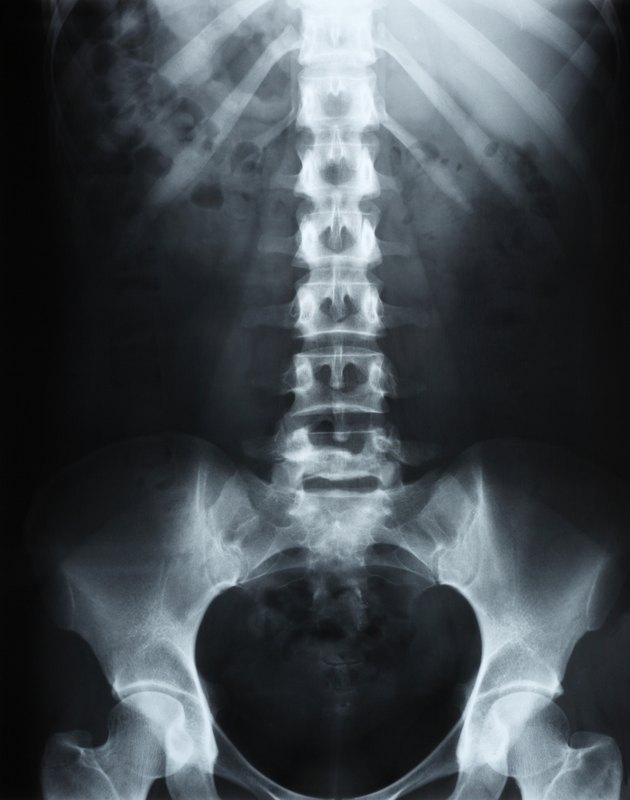 Human Spine X-Ray