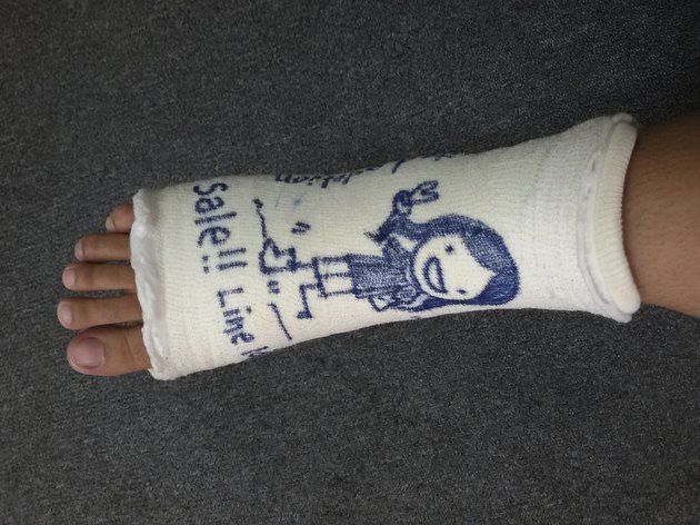Art on soft splint