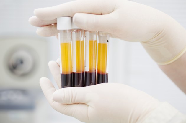 Preparing blood for Plasmolifting.