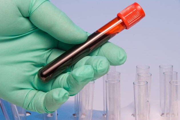 Green gloved hand holding blood sample in test tube