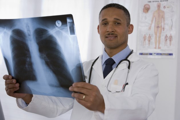 African doctor holding x-ray