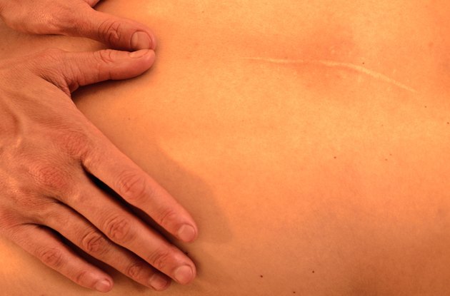Massaging Scarred Back