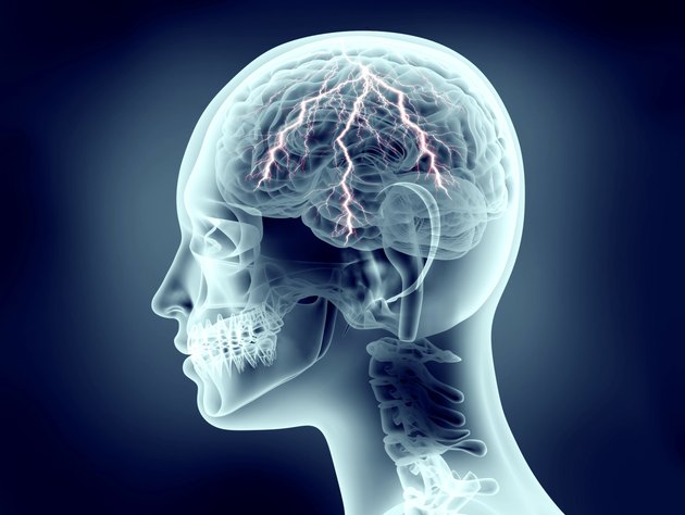xray image of human head with lightning