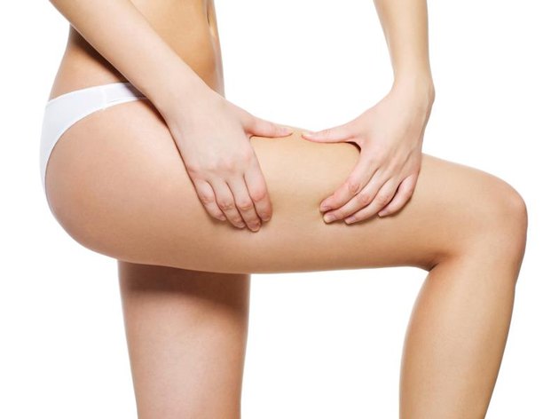 Female squeezes cellulite skin on her legs - close-up shot on white background