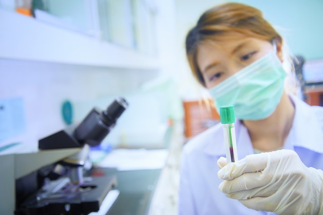 blood test tube in asia doctor hand
