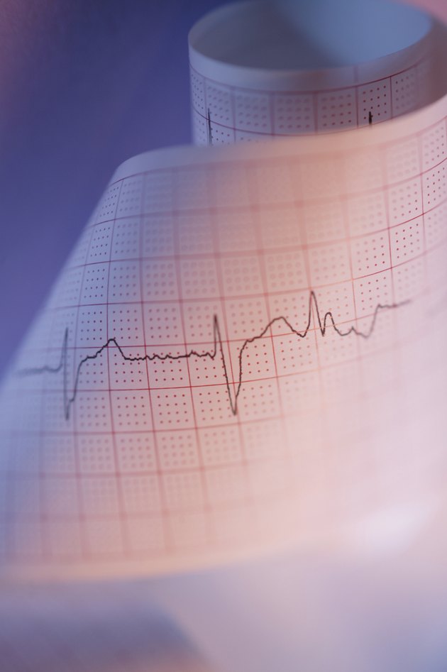 Close-up of EKG results