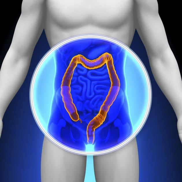 Medical X-Ray Scan - Colon