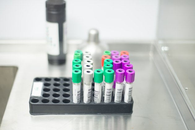 rack of color tubes with blood samples