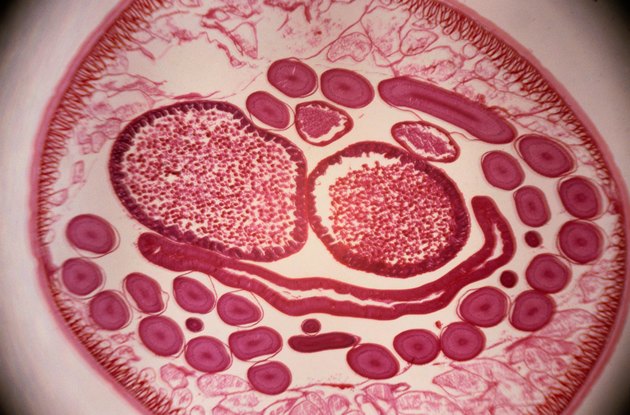 Microscopic Image of Roundworms