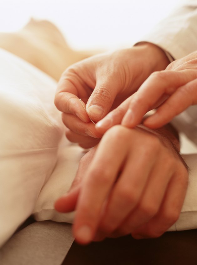 Man receiving acupuncture on hand, close-up