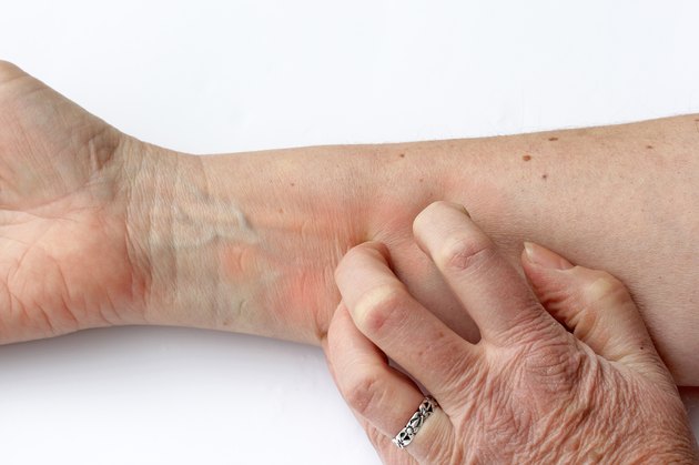 Itchy red skin